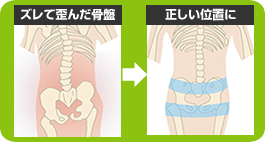 骨盤のズレが矯正される